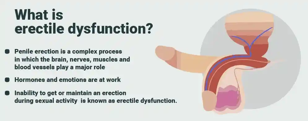 Cenforce 150 erectile dysfunction